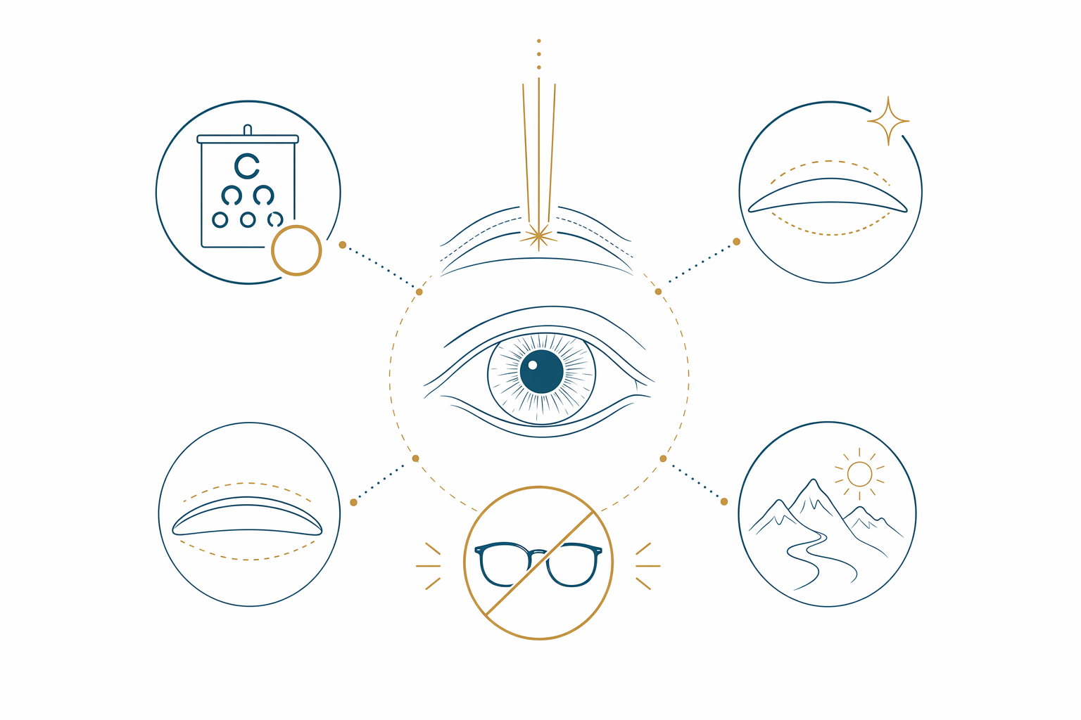What LASIK and laser vision correction are