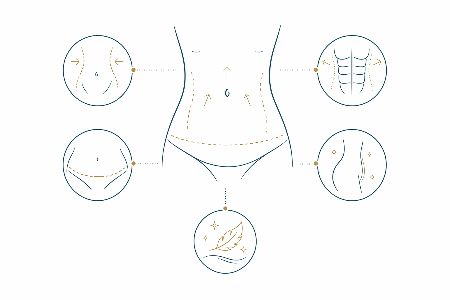 What a tummy tuck is